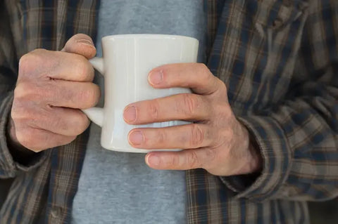 Person with very dry hands holding a mug, symbolizing winter skin dryness